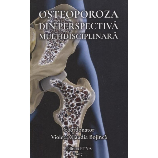 Osteoporoza din perspectiva multidisciplinara